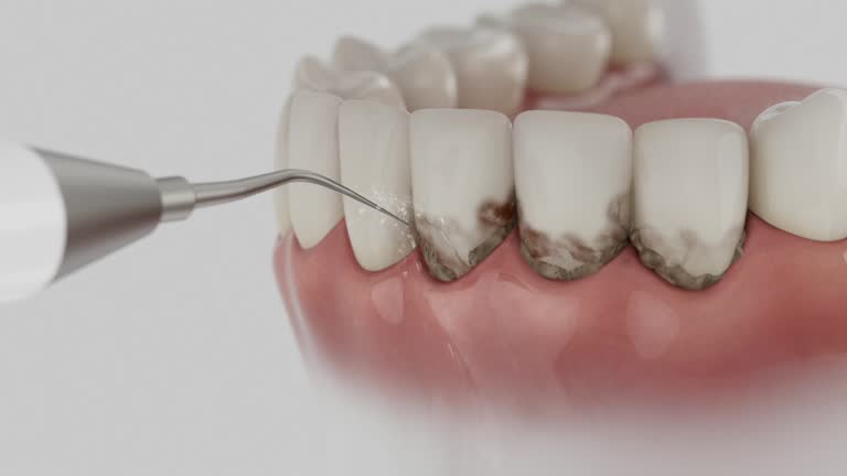 Trusted Emergency Dentist service in Fort Washington, MD - Dentist Open Now